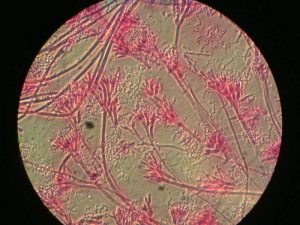 Mikroskopische AUfnahme von Schimmel Fruchtkörpern